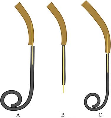 Double J stent malposition in the inferior vena cava: Two case reports and a literature review